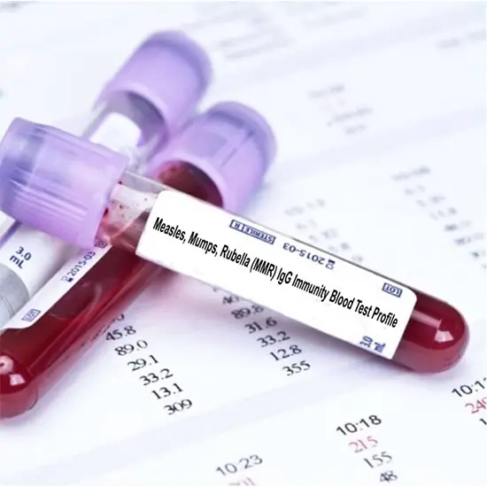Measles - PCR Quantitative